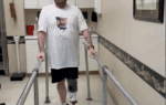 Man with a prosthetic leg practicing walking between parallel bars in a rehabilitation clinic.